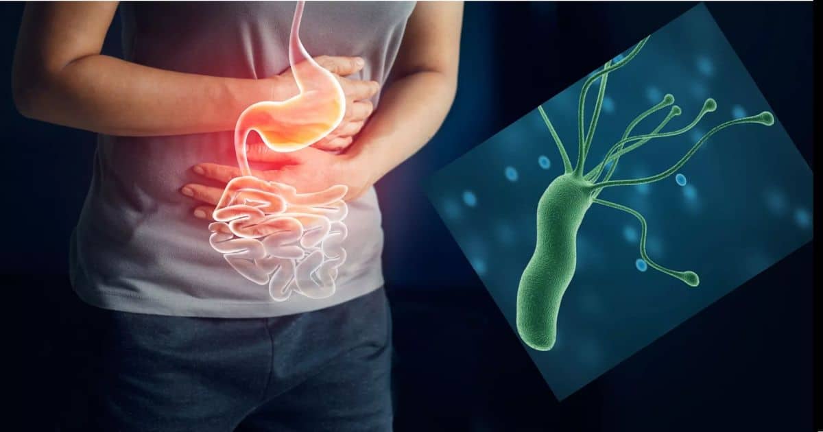 Santé au Cameroun – Helicobacter pylori et la nutrithérapie